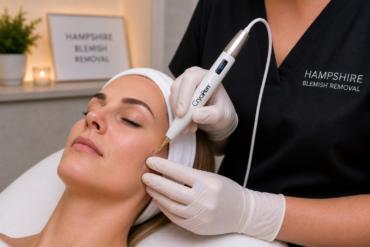 How Does Mole Screening Work?